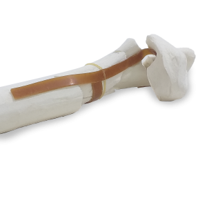 ÚMERO DIREITO COM FRATURAS MULTIPLAS - CÃO GRANDE PORTE - cód. AV302 DF1