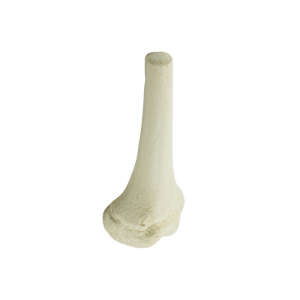 FÊMUR DISTAL - DIREITO - INFANTO JUVENIL - cód. 1013 D