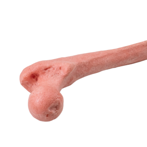 FÊMUR OSTEOPORÓTICO - DIREITO - cód. 12938