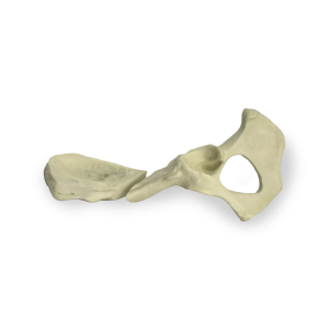 PÉLVIS ESQUERDA COM FRATURA MEDIAL - CÃO GRANDE PORTE - cód. AV402 EF1